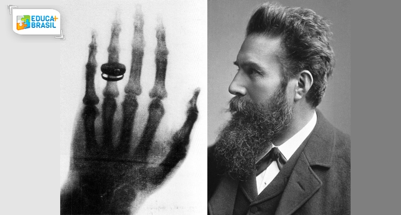 Como surgiu a Radiologia